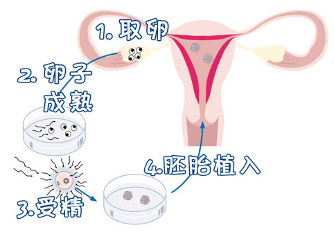 关于冰原生殖